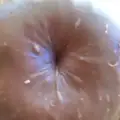 Rosette